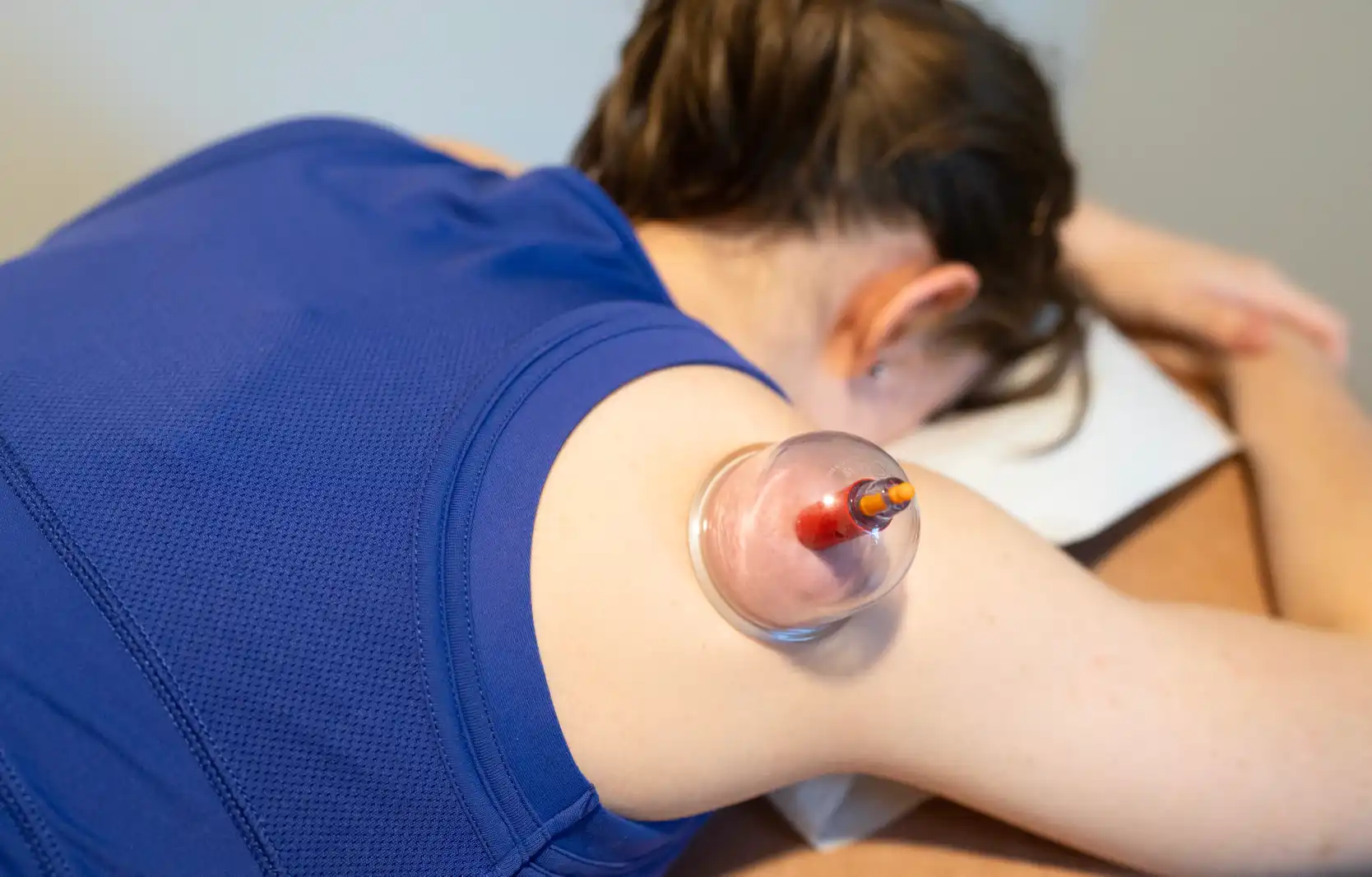 Cupping